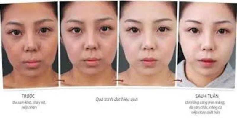 Bí quyết làm đẹp da từ bên trong – Cấu trúc da