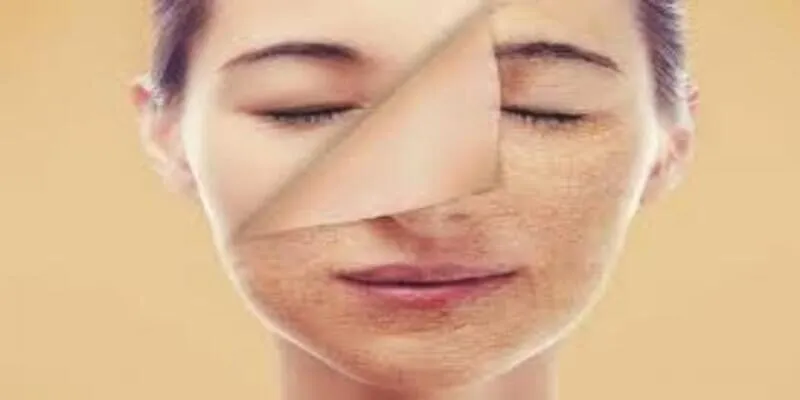 Massage mặt - Tạm biệt làn da chảy xệ và nhăn nheo